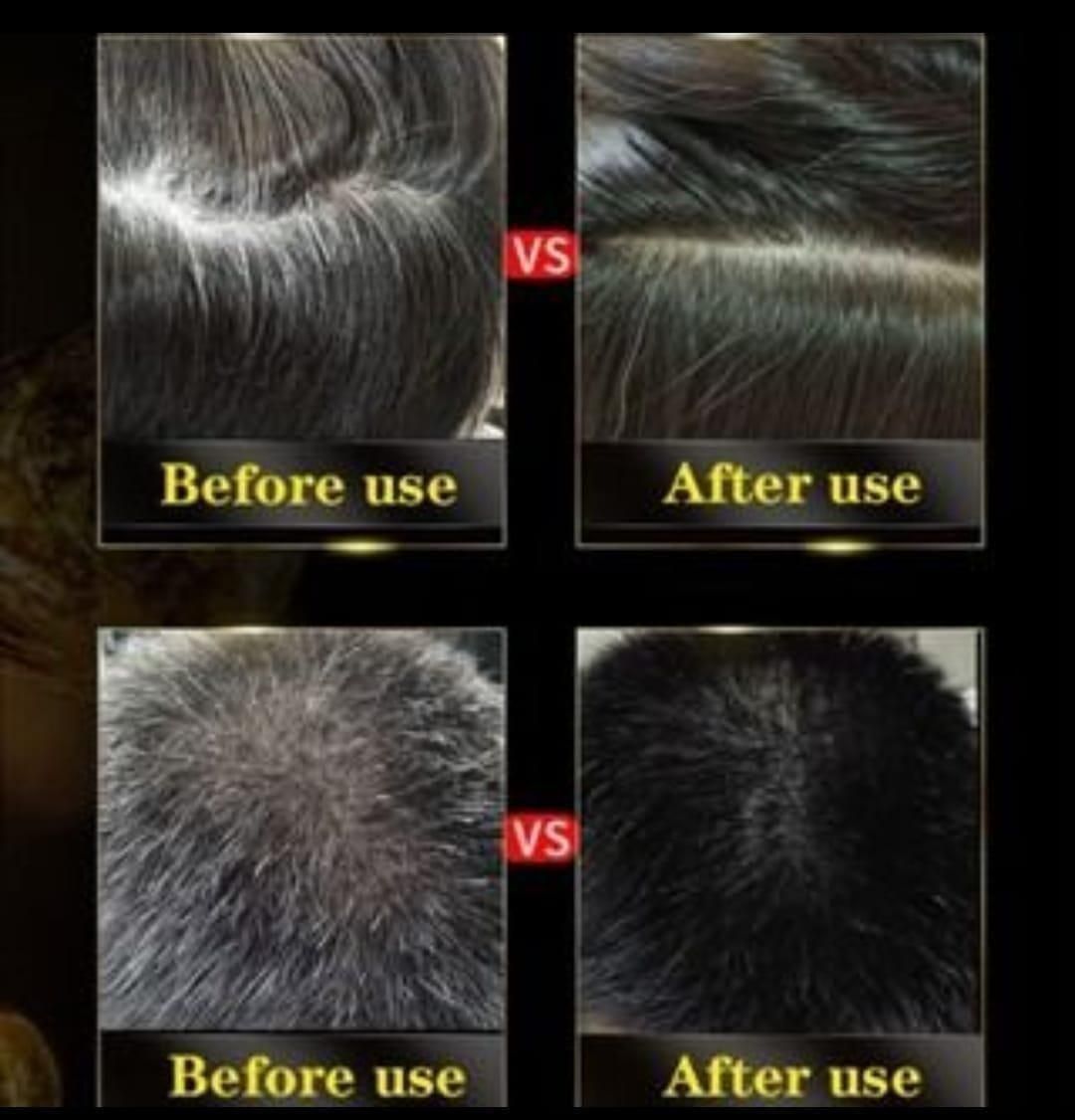 Unisex Instant Black Herbal Hair Dye Shampoo | 3-in-1 Grey Hair Coverage | Natural Herbal Extracts | 100ml Each (Pack of 2)