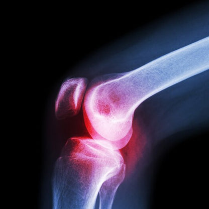 Knee Sleeve for Knee Support (XL) 1 pc