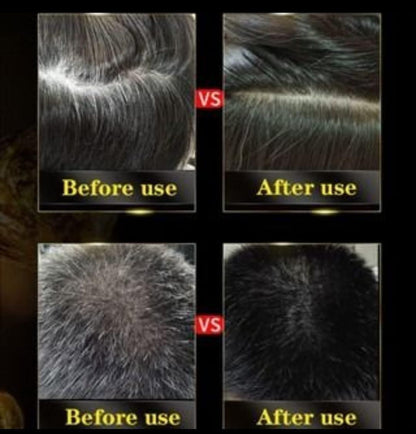 Unisex Instant Black Herbal Hair Dye Shampoo | 3-in-1 Grey Hair Coverage | Natural Herbal Extracts | 100ml Each (Pack of 2)