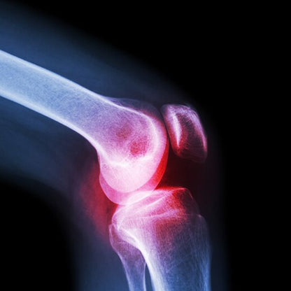 Knee Sleeve for Knee Support (Large) 1 pc